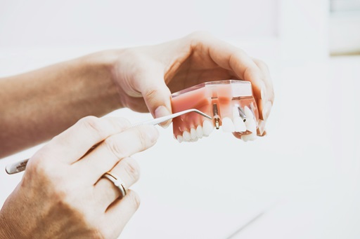 Ventajas y Desventajas de la Cosmética Dental